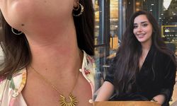 Vanlı Avukat Buse Bacaru Saldırıya Uğradı