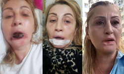Dudak Dolgusu Sonrası Dudağı Çürüdü: 7 Yıldır Adalet Bekliyor